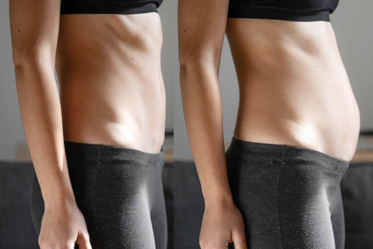 How long does diastasis recti take to improve Maidenhead?