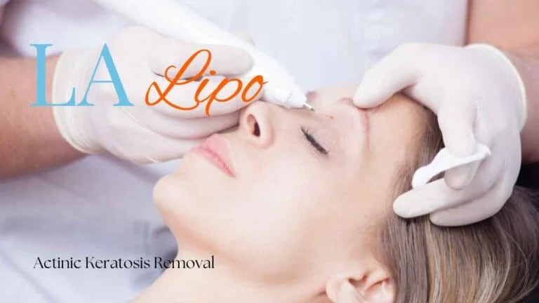 Woman receiving Actinic Keratosis Removal Treatment Maidenhead
