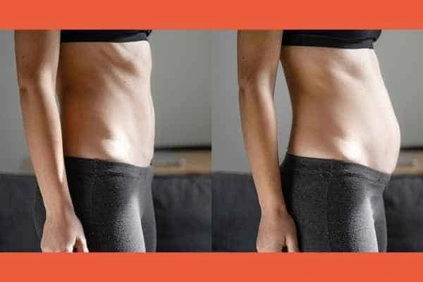 LA-EMS Body Sculpting results Maidenhead