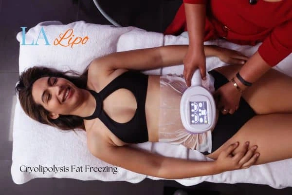 woman getting cryolipolysis Maidenhead