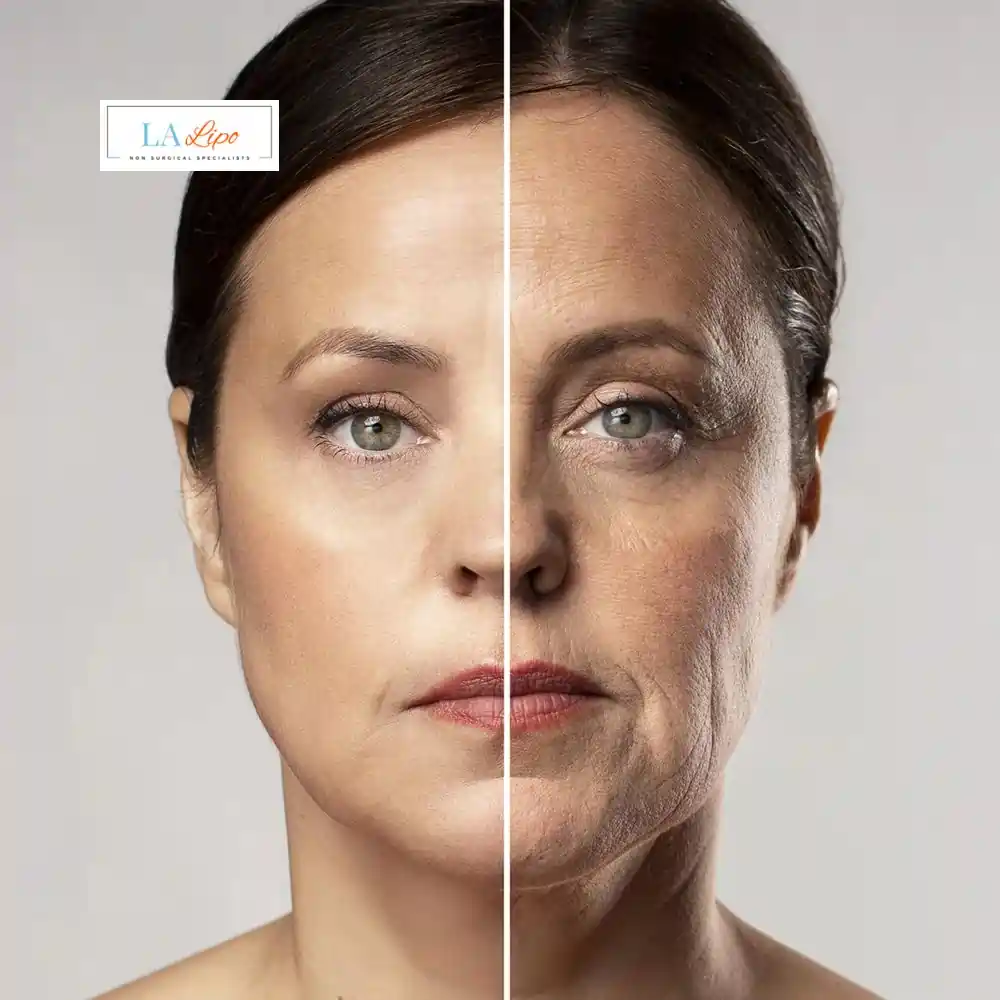 How Can You Tell If Non-Surgical Skin Tightening Is Right for You Maidenhead?