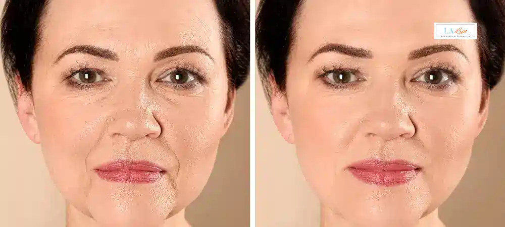 How Long Does It Take to See Results and How Long Do They Last Maidenhead?
