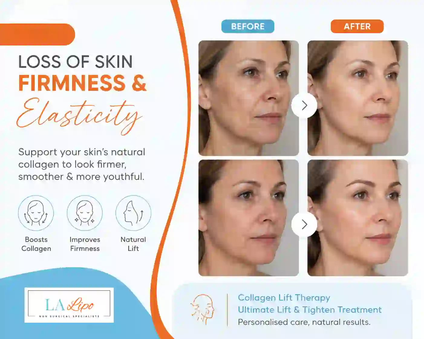 Sign #7: Loss of Skin Firmness and Elasticity Maidenhead