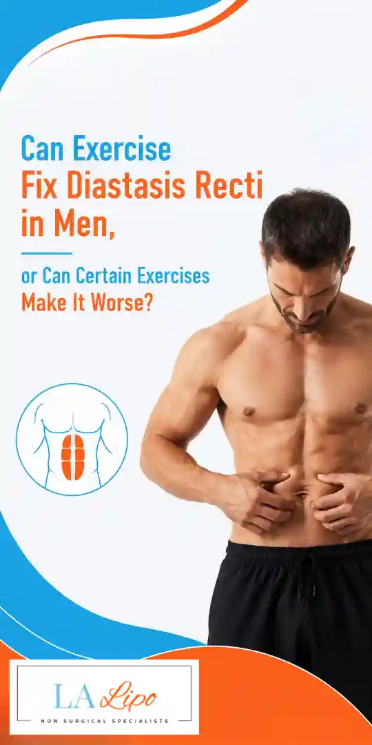 Can Exercise Fix Diastasis Recti in Men, or Can Certain Exercises Make It Worse Maidenhead?